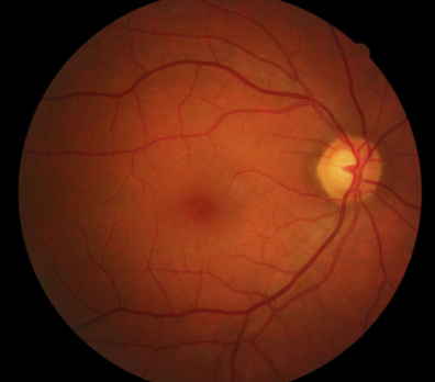 eye.png